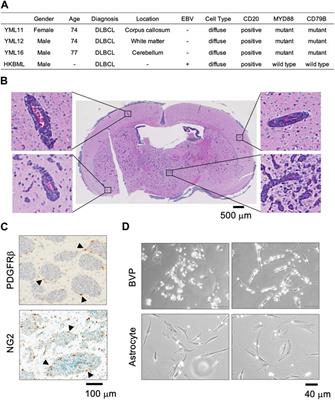 Development of a contacting transwell co-culture system for the in vitro propagation of primary central nervous system lymphoma